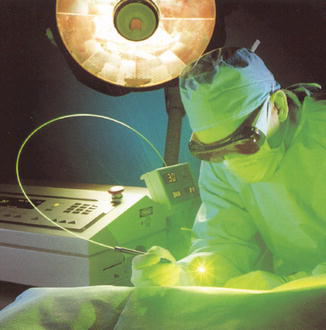 Surgical laser system equipped with an optical fiber