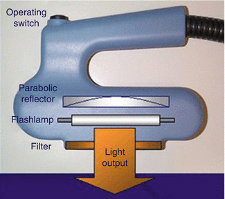 Schematics of an intense pulsed light system, by Lumenis