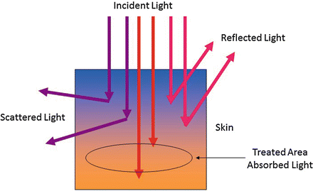 Light–tissue interaction: an incident beam is transmitted, reflected, scattered and absorbed