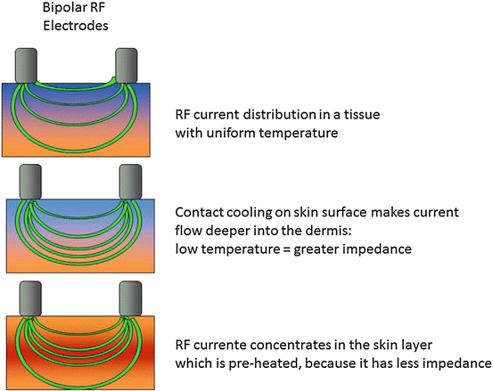 Effect of a cooling contact tip on a bipolar RF current, directing the current deeper into the dermis