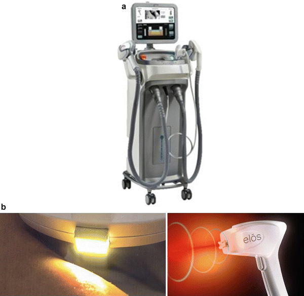 (a) ELOS Plus multiplatform system with several handpieces including laser, IPL, infrared and fractional RF; (b) ELOS handpiece showing bipolar electrodes and IPL simultaneously, by Syneron Candela