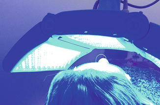 にきびに対して青色光LED治療を受けている患者